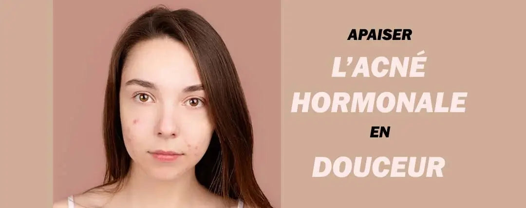 Acné Hormonale : Les Accessoires Beauté qui Peuvent Faire la Différence