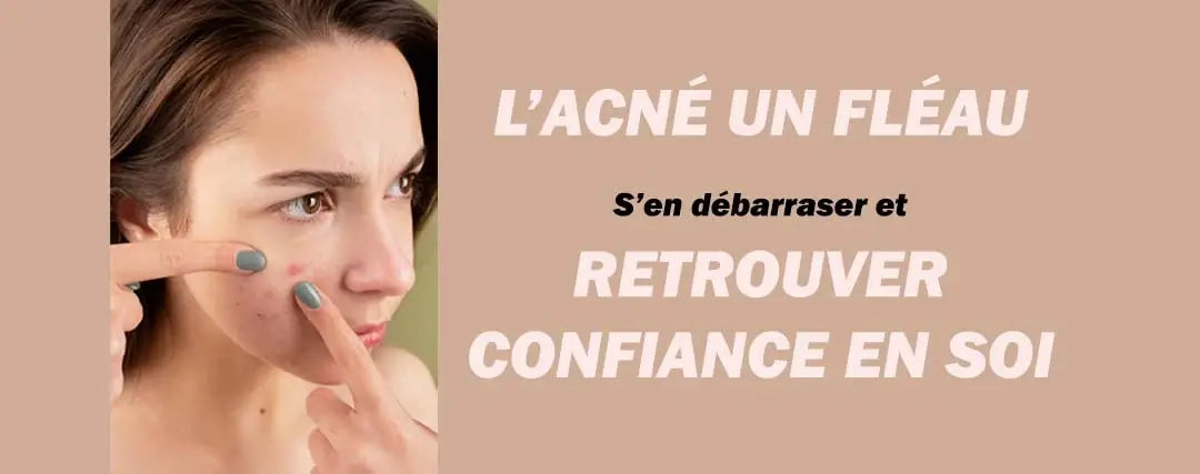 Peau parfaite : Les secrets pour éliminer l'acné et retrouver confiance en soi