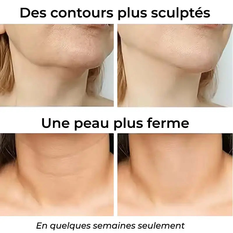 Les effets incroyables de l'appareil de lifting