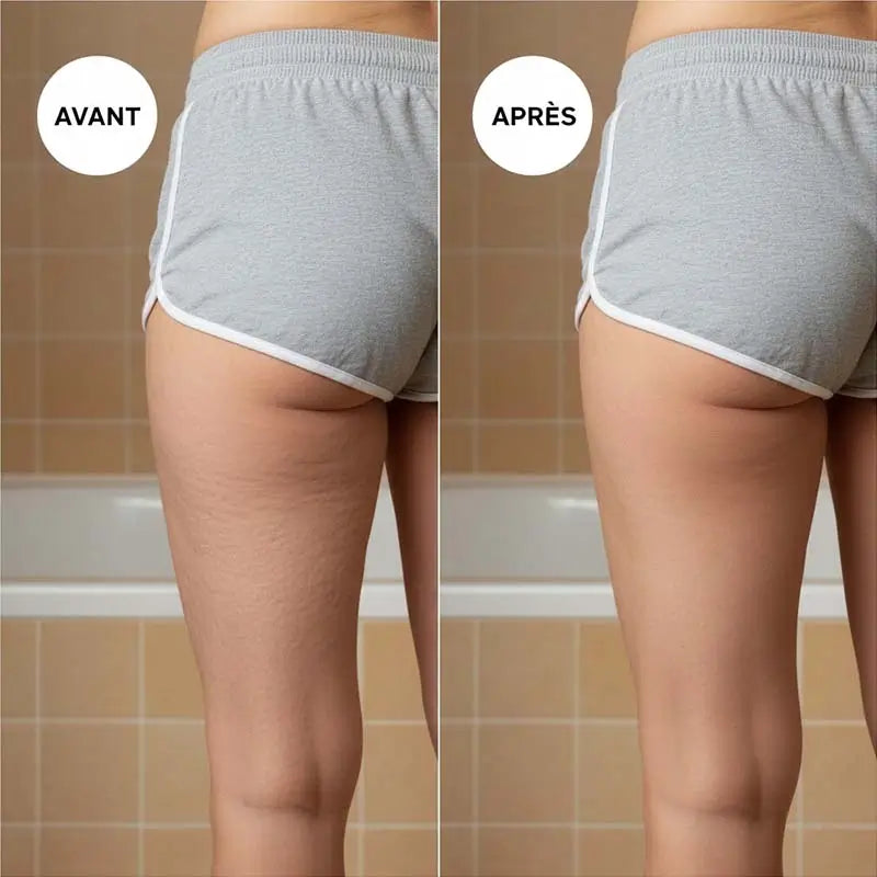 Brosse Anti-Cellulite