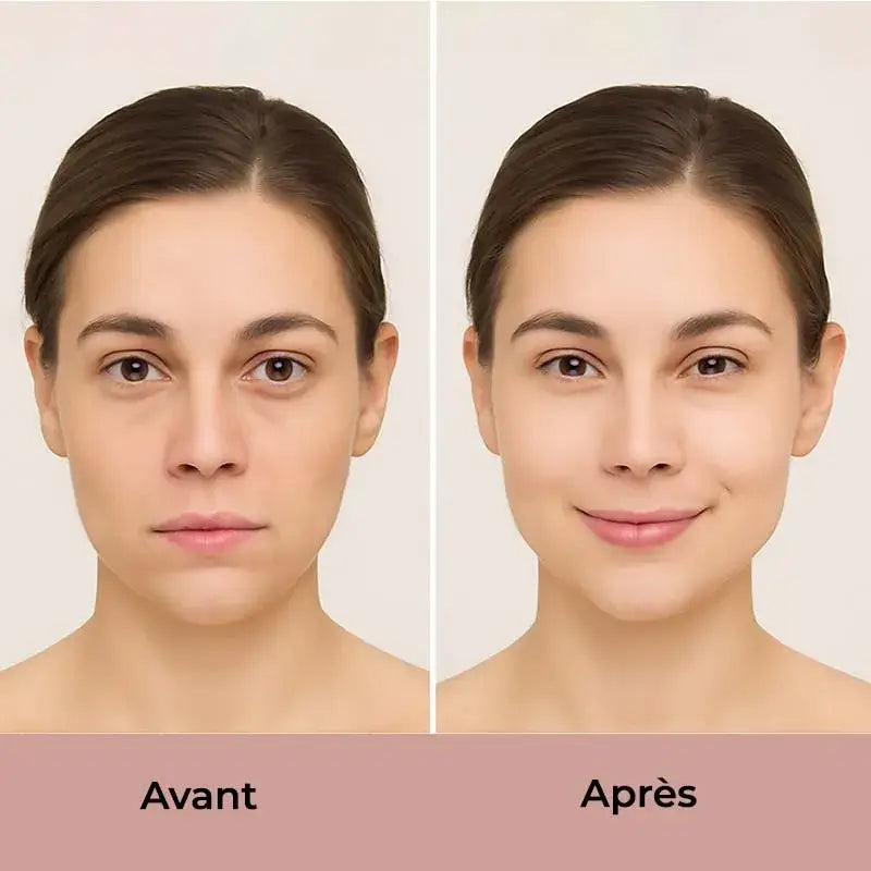 Gua sha avant après