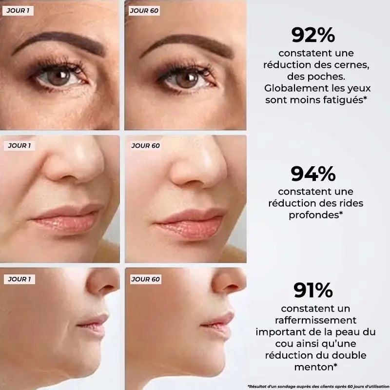 Appareil Micro-Courant Visage