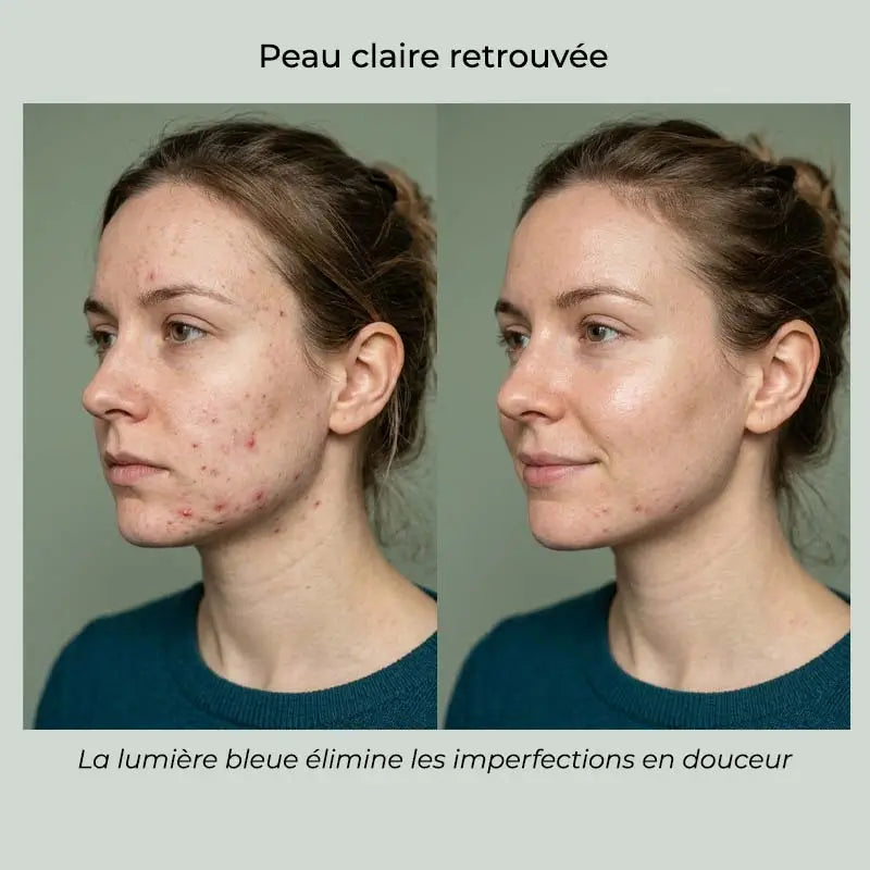LumaGlow™ - Masque LED Visage & Cou 7 Couleurs
