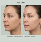 LumaGlow™ - Masque LED Visage & Cou 7 Couleurs
